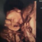 3D of my babys face