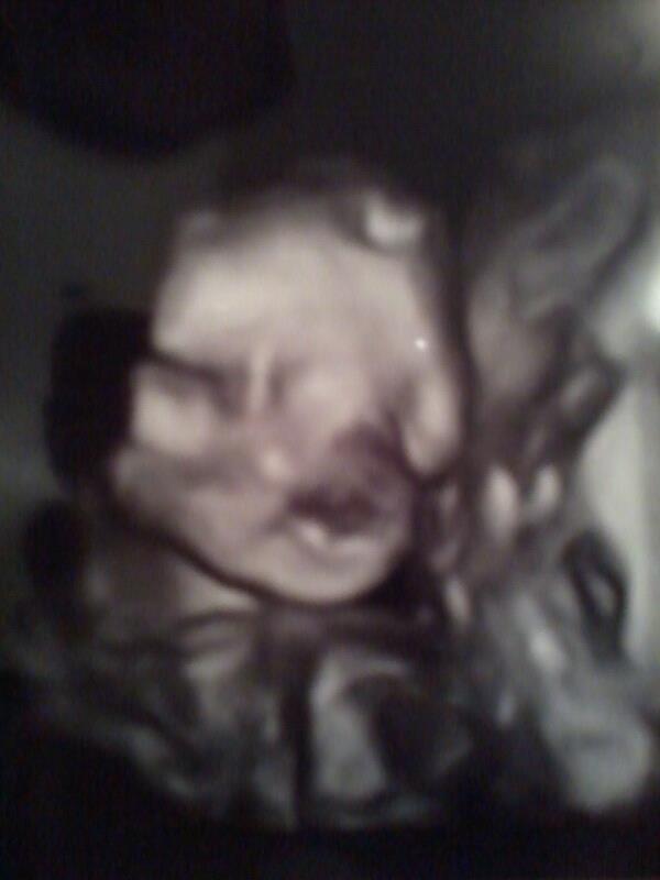 Regular ultrasound of my babys face