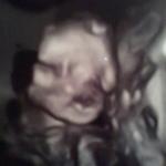 Regular ultrasound of my babys face