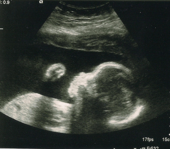 26 week scan - My little activist lol...was joking that's a "fight the power" fist ;)