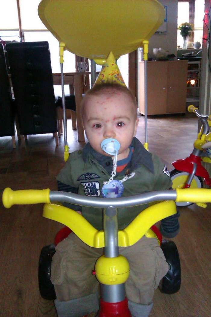 jake on his bike on his birthday with chicken pox