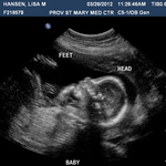 well it looks like she grew into her due date august 11th=) shes 14oz now
