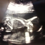 Baby A laying on his tummy with his butt in the air lol 20 wks