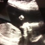 Baby B with his fist up 20 wks
