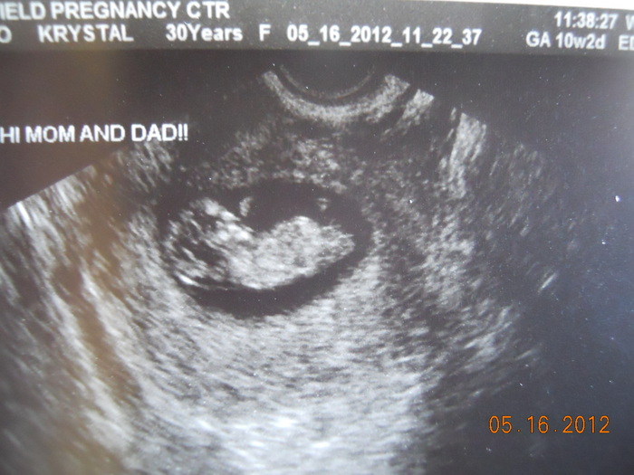 5.16.12 . 10w 2d measured 11w. The baby looked like it was waving