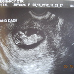 5.16.12 . 10w 2d measured 11w. The baby looked like it was waving