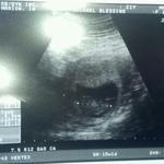 our peanut at 10 weeks 1 day!!