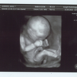 16 week, 5 day ultrasound - 3D