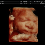 Aiden's 31 Week 'fun scan' Ultrasound