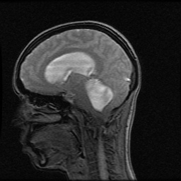 First MRI- explains why surgery was 4 days later.