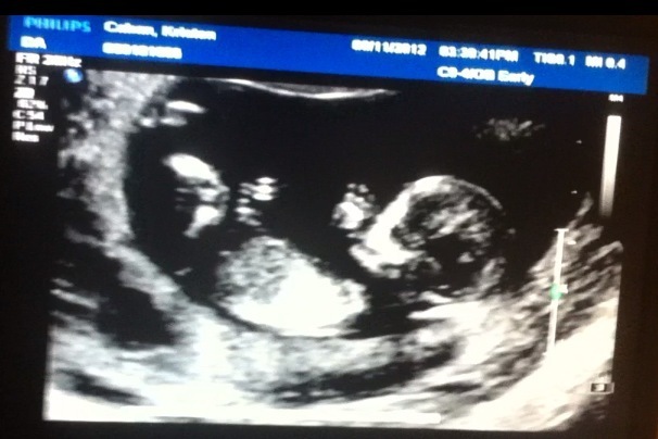 Baby Caban 12 weeks~! It's a BOY