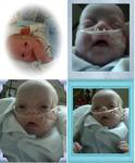 David Benjamin, sisters baby. Born at 20 weeks on May 6th at 1.2 lbs and 9 in, now 4.4 lbs and 14 in