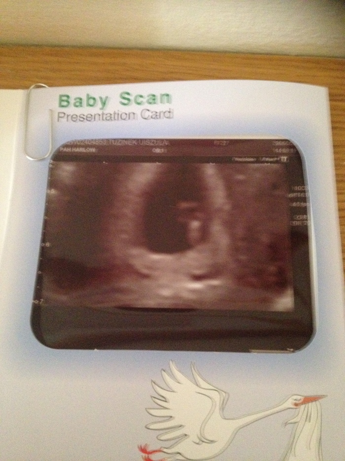 Baby's first scan - 6 weeks and 2 days