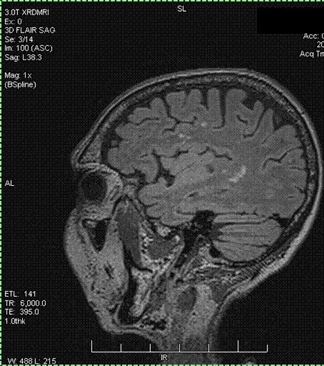 MRI July 2012- T3