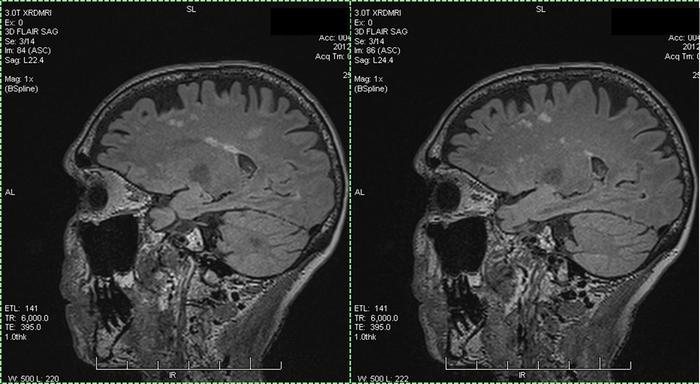 MRI 2012- T3