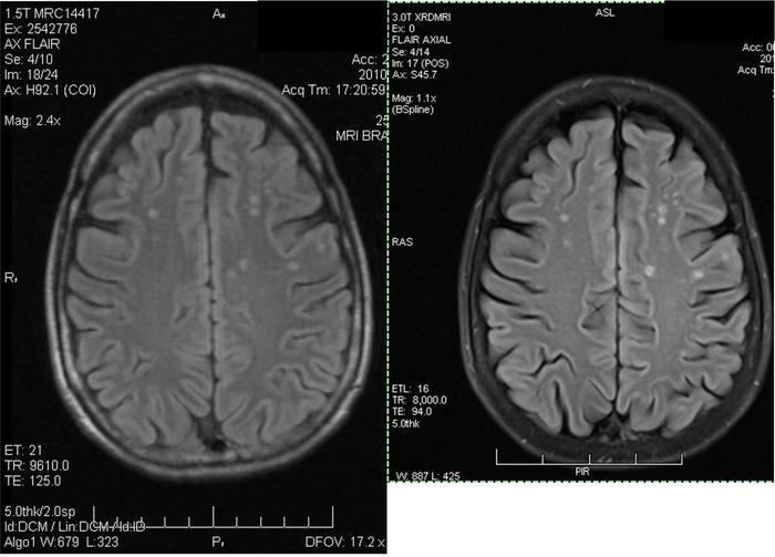MRI 2010 vs 2012