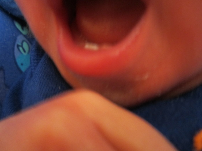 Aiden's first tooth--he was born with it!!!