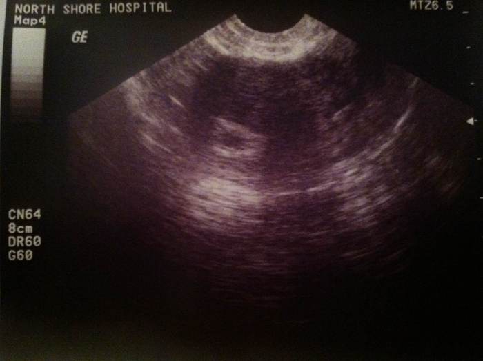 Our first baby picture!