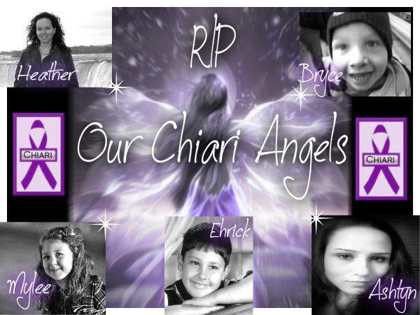 these are just a few of my chiari family who were taken way before their time!  RIP