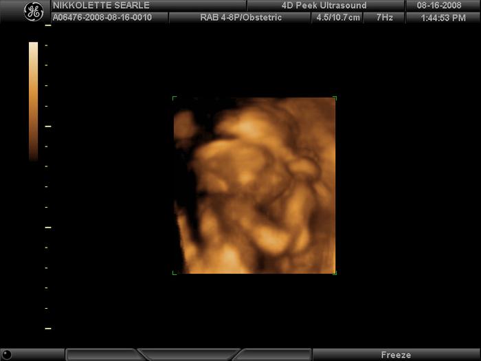 I couldn't keep my hands out of my face. So, mommy and daddy didn't get any good face shots...