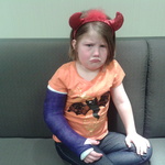 Kirby broke her arm on Halloween! She was MAD ;)