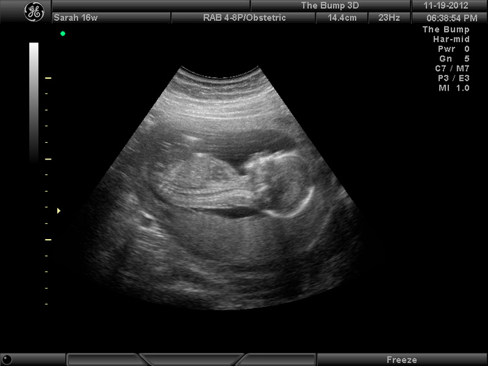 Profile of our beautiful baby girl!