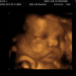 32.5weeks
look at those big lips and cute nose