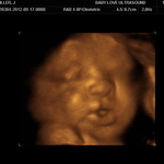 32.5weeks
look at those big lips and cute nose