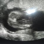Its A GIRL!!! :) 20 weeks.