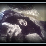 ♥ Our Handsome Son at 21 weeks! 1 lb. 1 oz. ♥