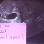 6 weeks
Heartbeat!!