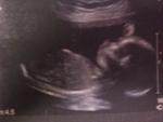 19 weeks..and im a boy!!!