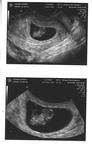 Our first ultrasound at 8 weeks.  Pregnant with first child!