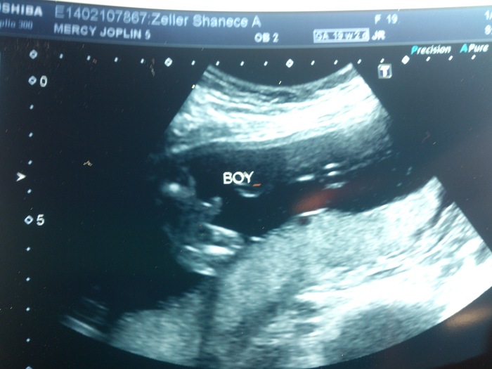 its a boy! 