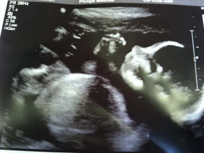 Luke, wk 23 - a little smooshed in the pic, but he's healthy & waving!