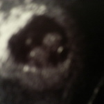 first ultrasound 7+4 weeks
