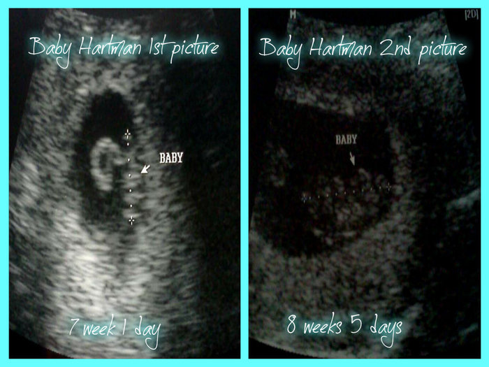 I can not wait to meet this new little life<3 I have waited over 5 years for<3