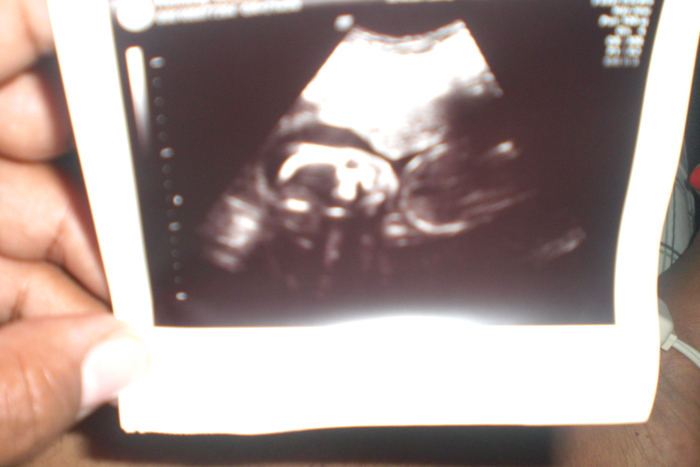 3/19 the alien pic...21 weeks 3 days