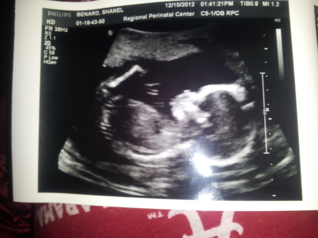 First ultrasound pics