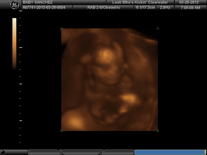 Baby face 19 weeks 3 days