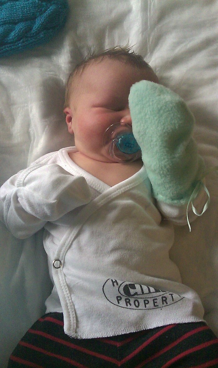 The NICU stay left him with this silly arm thing