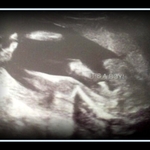 ♥ 21 weeks - It's a boy! ♥