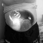 My belly and an 18 wk ultrasound :)