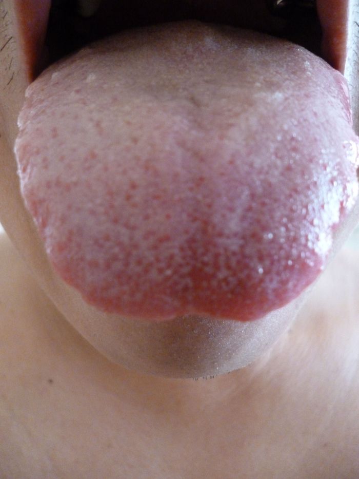 Tongue after waking up. December 2012