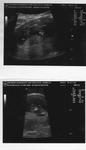 more ultrasouns pics