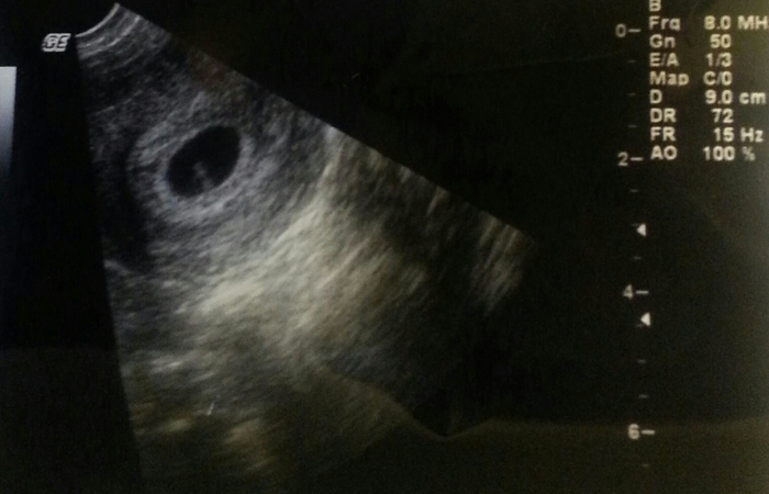 My babies first photo :)
