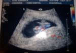 7 weeks 1 day ultrasound