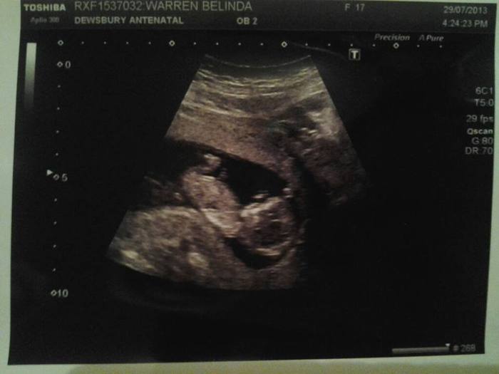 the first time i saw my baby.. 12 week 2 days