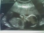 baby boy sucking his thumb at 19 weeks