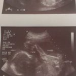 21 weeks ultrasound BOY